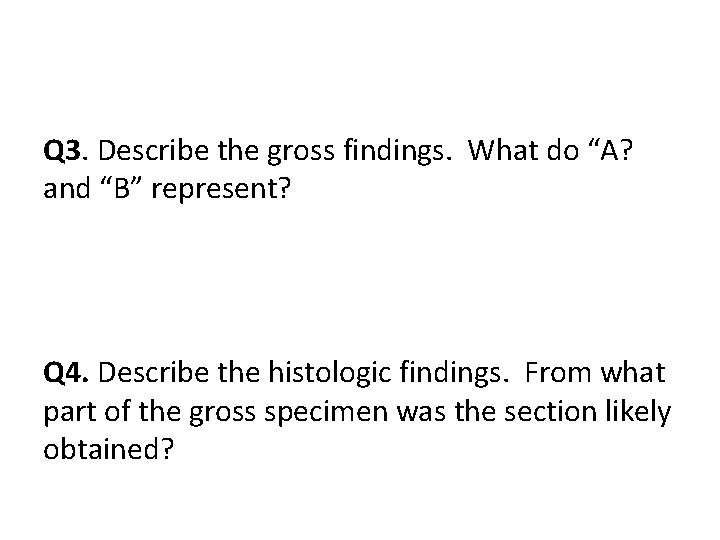 Q 3. Describe the gross findings. What do “A? and “B” represent? Q 4.