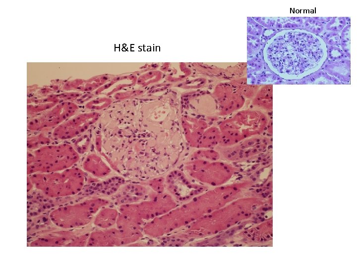 Normal H&E stain 