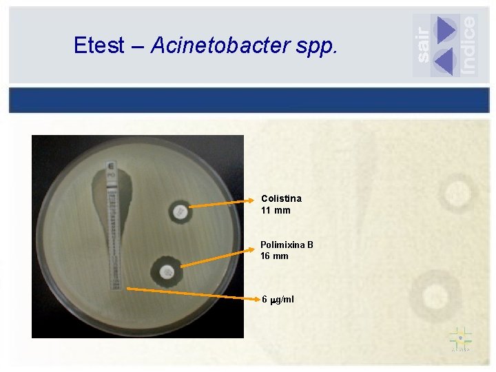 Etest – Acinetobacter spp. Colistina 11 mm Polimixina B 16 mm 6 g/ml 