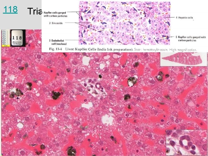 118 Triad with bile duct in Liver & spleen with colloidal carbon, rat 