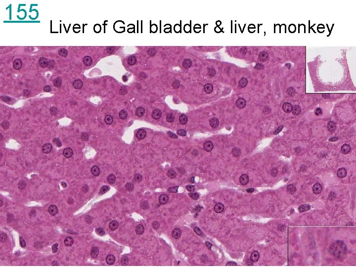 155 Liver of Gall bladder & liver, monkey 