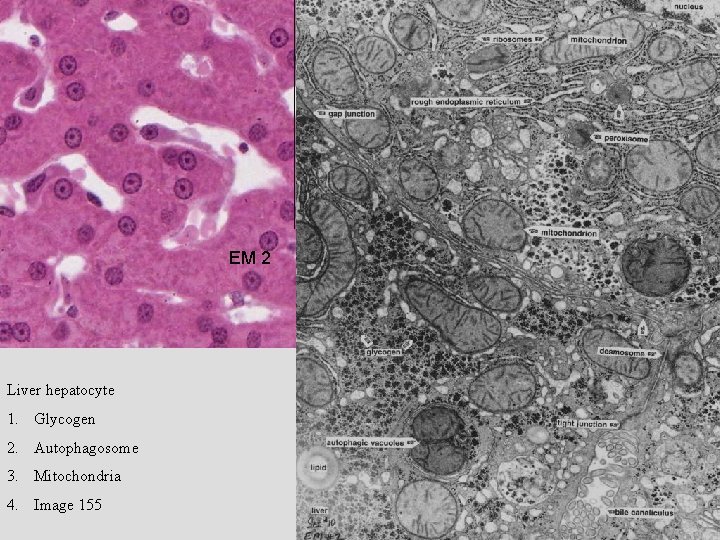 EM 2 Liver hepatocyte 1. Glycogen 2. Autophagosome 3. Mitochondria 4. Image 155 