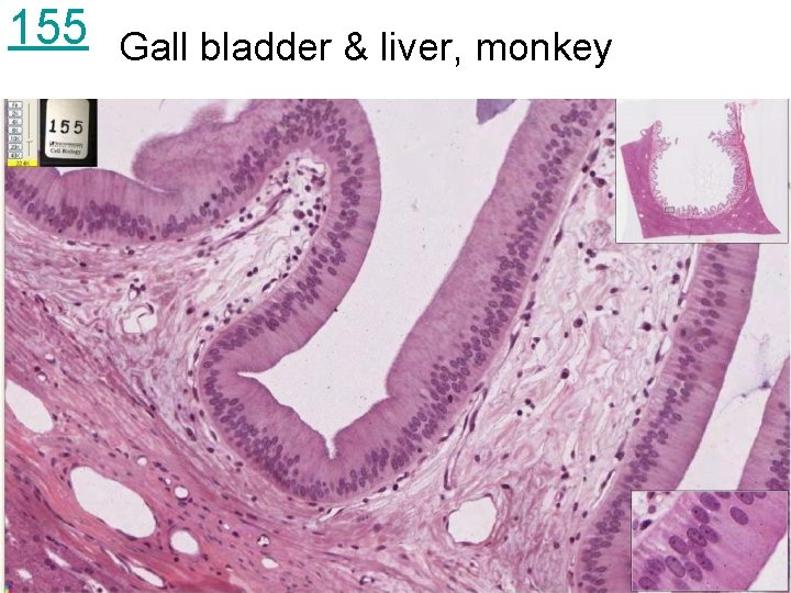 155 Gall bladder & liver, monkey 