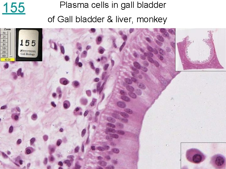 155 Plasma cells in gall bladder of Gall bladder & liver, monkey 