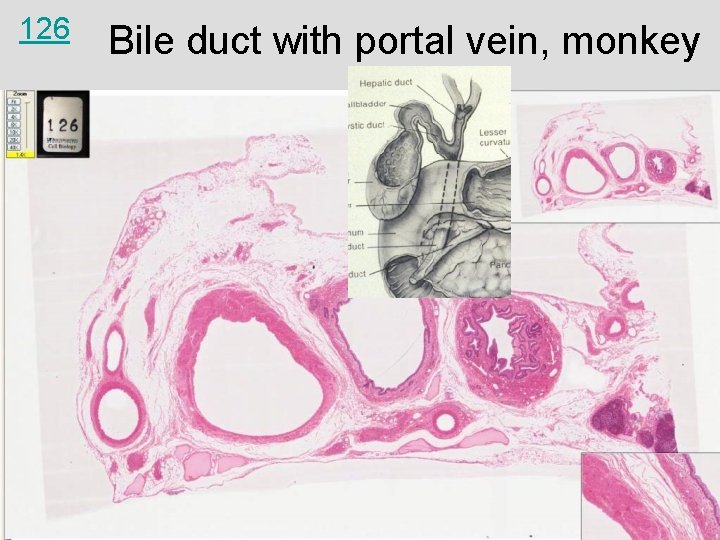 126 Bile duct with portal vein, monkey 