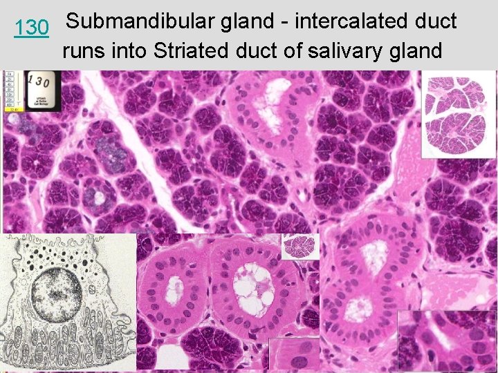 130 Submandibular gland - intercalated duct runs into Striated duct of salivary gland 