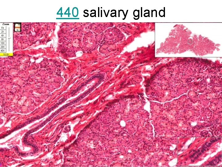 440 salivary gland 