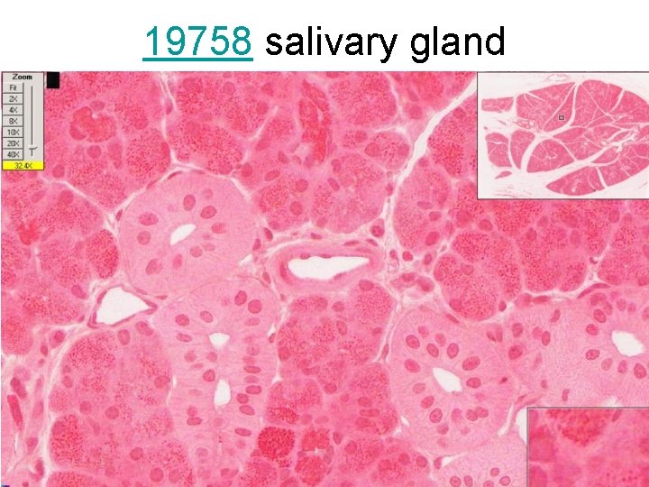 19758 salivary gland 