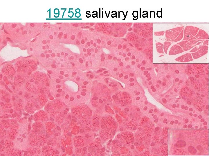 19758 salivary gland 