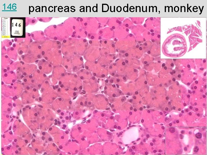 146 pancreas and Duodenum, monkey 