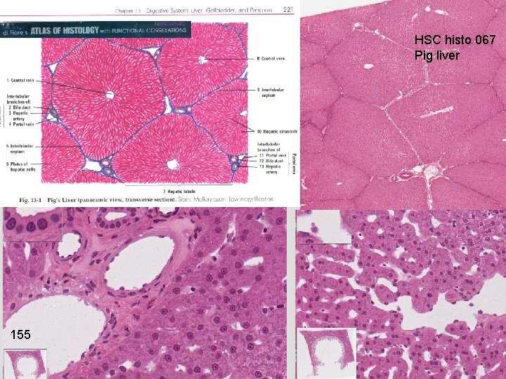 HSC histo 067 Pig liver 155 