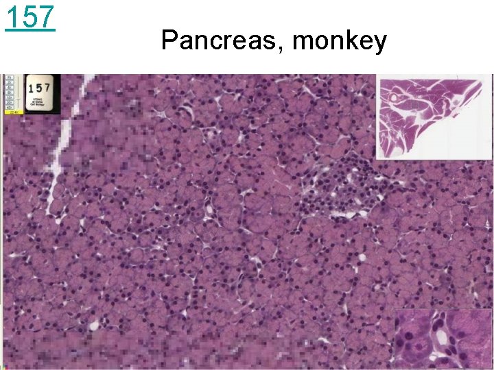 157 Pancreas, monkey 