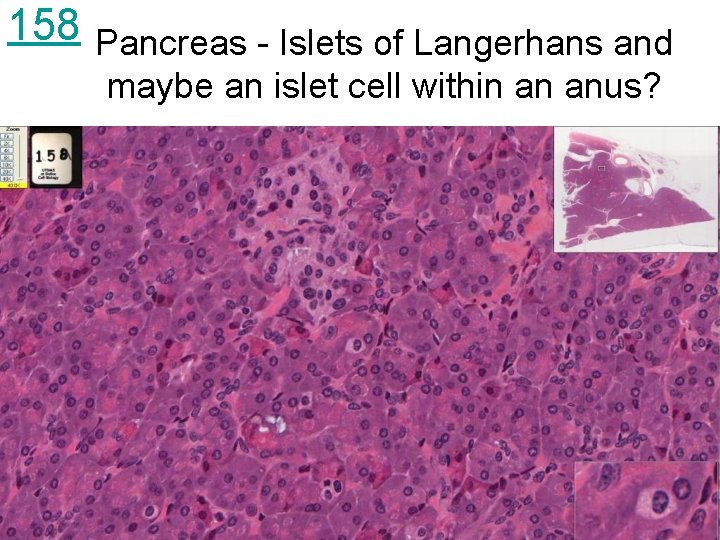 158 Pancreas - Islets of Langerhans and maybe an islet cell within an anus?