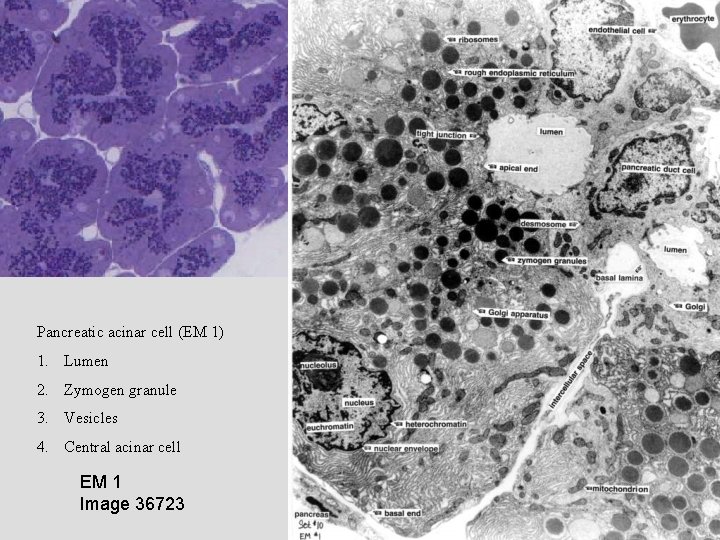 Pancreatic acinar cell (EM 1) 1. Lumen 2. Zymogen granule 3. Vesicles 4. Central