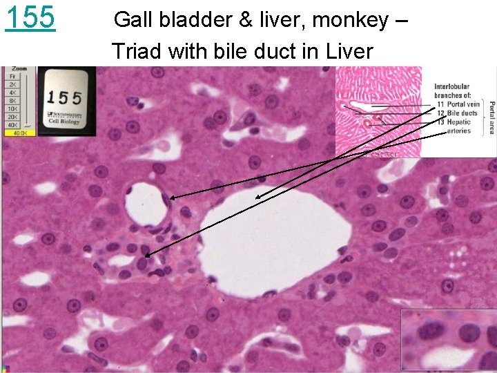 155 Gall bladder & liver, monkey – Triad with bile duct in Liver 