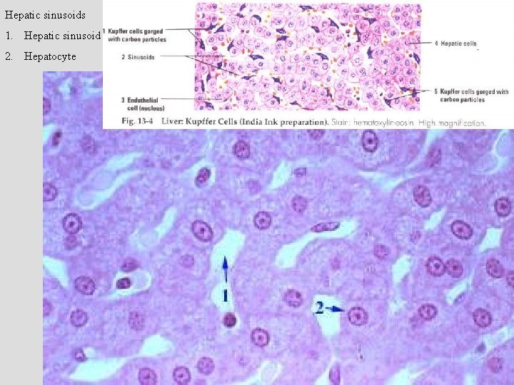 Hepatic sinusoids 1. Hepatic sinusoid 2. Hepatocyte 