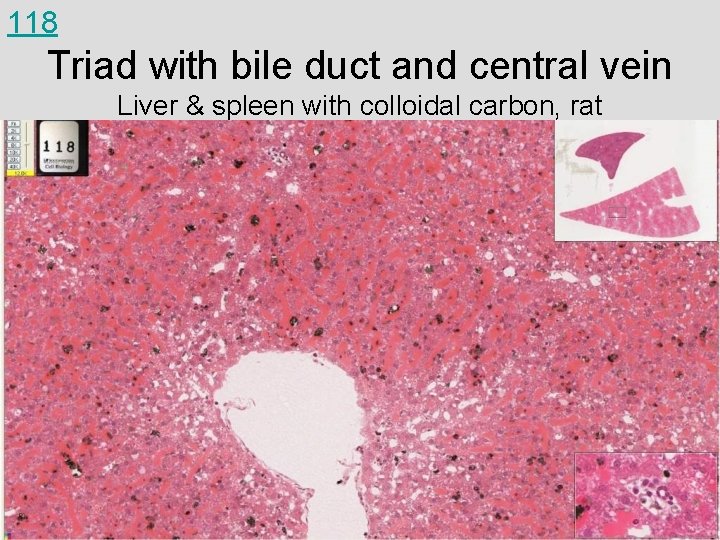 118 Triad with bile duct and central vein Liver & spleen with colloidal carbon,