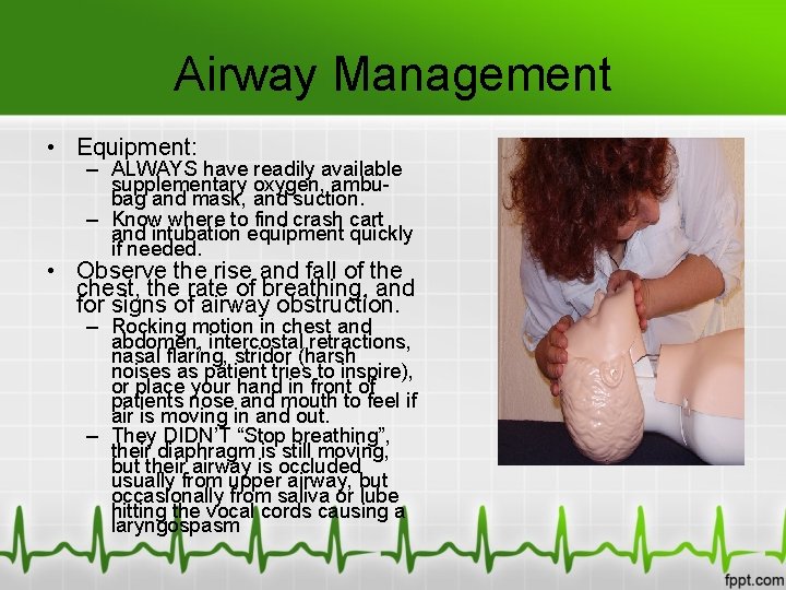 Airway Management • Equipment: – ALWAYS have readily available supplementary oxygen, ambubag and mask,