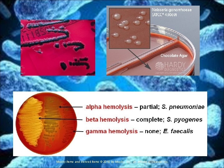 Mosby items and derived items © 2010 by Mosby, Inc. , an affiliate of