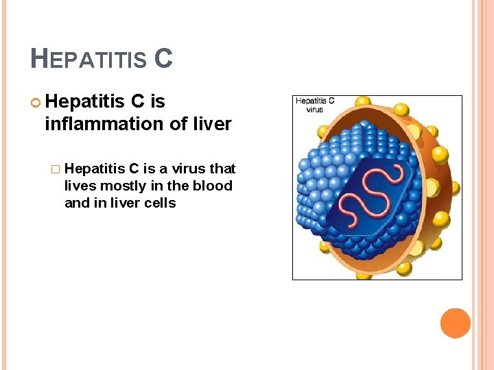 HEPATITIS C Hepatitis C is inflammation of liver � Hepatitis C is a virus