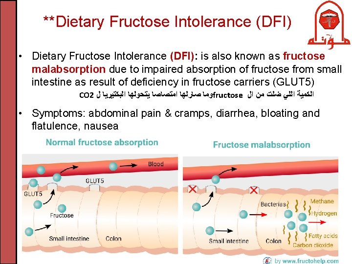 **Dietary Fructose Intolerance (DFI) • Dietary Fructose Intolerance (DFI): is also known as fructose