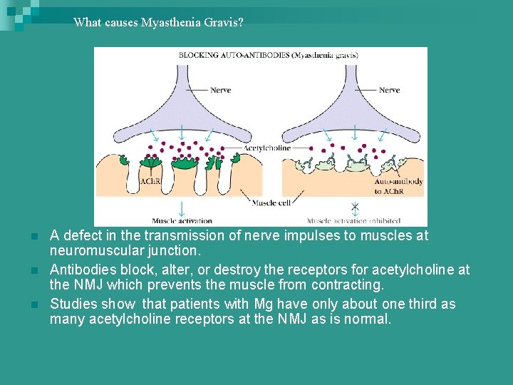 What causes Myasthenia Gravis? What causes MG? n n n A defect in the