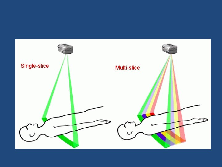 Single-slice Multi-slice 