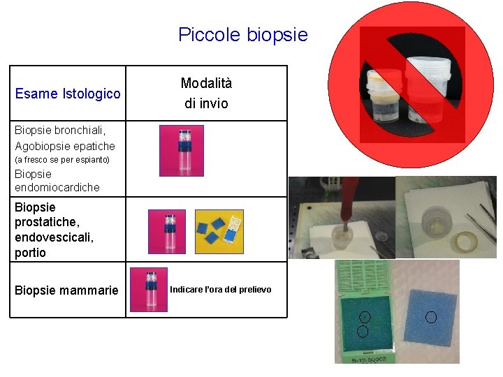 Piccole biopsie Esame Istologico Modalità di invio Biopsie bronchiali, Agobiopsie epatiche (a fresco se