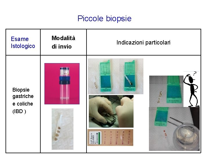 Piccole biopsie Esame Istologico Biopsie gastriche e coliche (IBD ) Modalità di invio Indicazioni