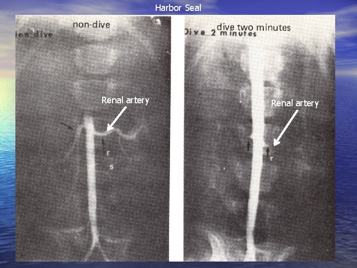 Harbor Seal Renal artery 