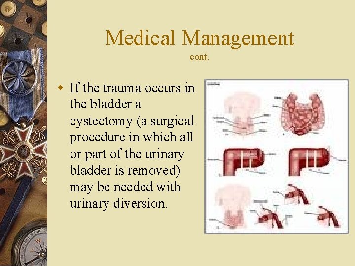 Medical Management cont. w If the trauma occurs in the bladder a cystectomy (a