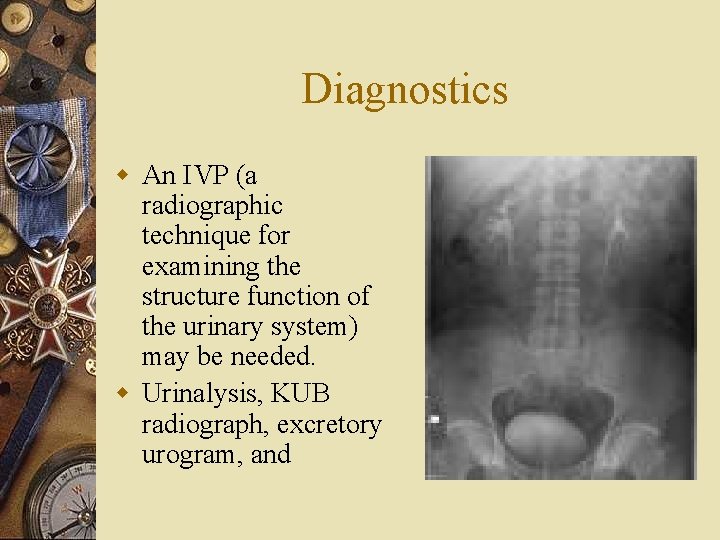 Diagnostics w An IVP (a radiographic technique for examining the structure function of the