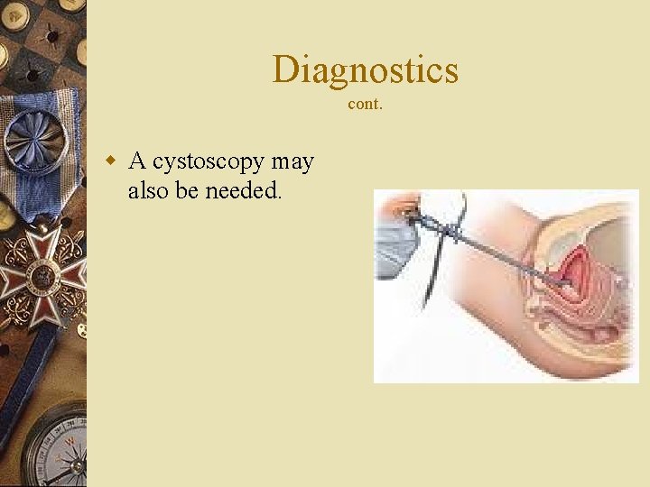Diagnostics cont. w A cystoscopy may also be needed. 