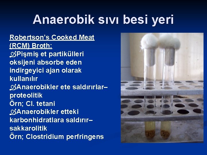 Anaerobik sıvı besi yeri Robertson’s Cooked Meat (RCM) Broth: Pişmiş et partikülleri oksijeni absorbe