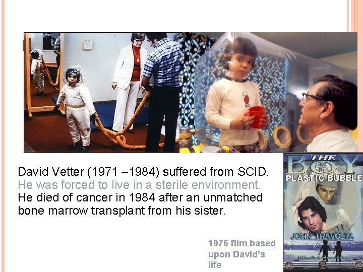 BUBBLE BABY SYNDROME David Vetter (1971 – 1984) suffered from SCID. He was forced