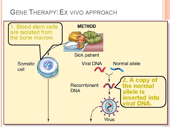 GENE THERAPY: EX VIVO APPROACH 1. Blood stem cells are isolated from the bone