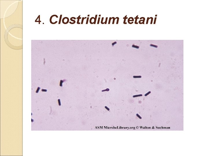 4. Clostridium tetani 