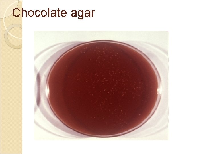 Chocolate agar 