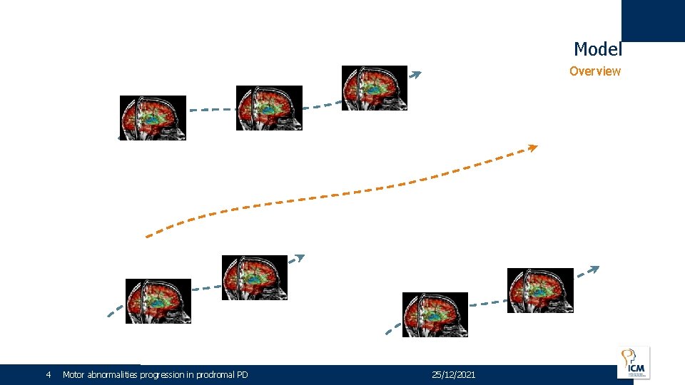 Model Overview 4 - 25/12/2021 4 Motor abnormalities progression in prodromal PD 25/12/2021 
