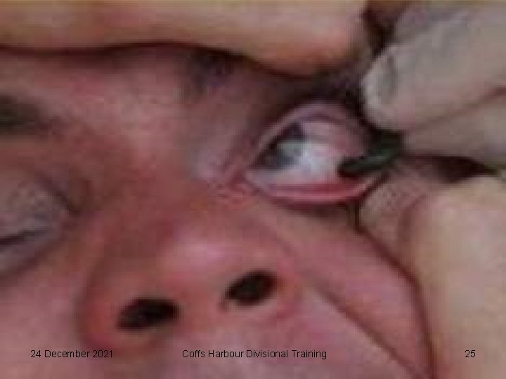 24 December 2021 Coffs Harbour Divisional Training 25 