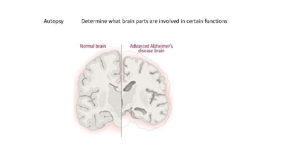 Autopsy Determine what brain parts are involved in certain functions 