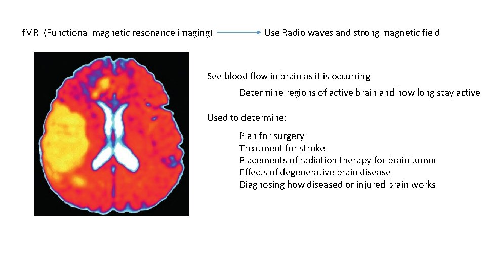 f. MRI (Functional magnetic resonance imaging) Use Radio waves and strong magnetic field See