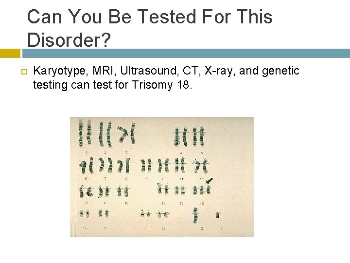 Can You Be Tested For This Disorder? Karyotype, MRI, Ultrasound, CT, X-ray, and genetic