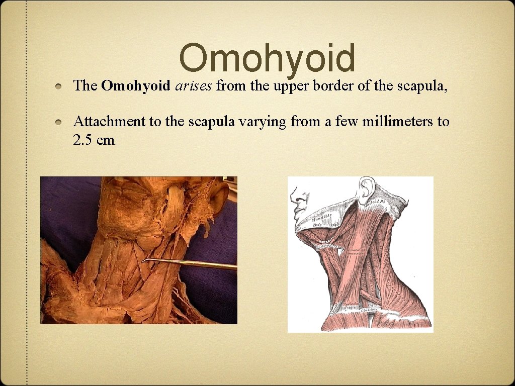Omohyoid The Omohyoid arises from the upper border of the scapula, Attachment to the