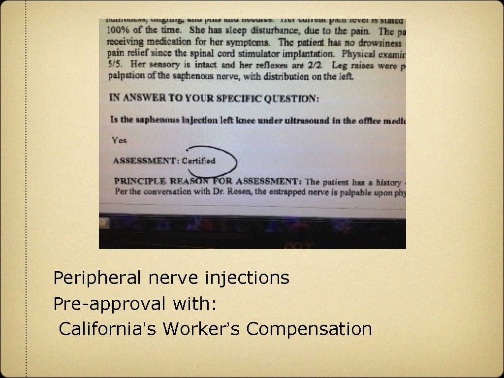 Peripheral nerve injections Pre-approval with: California’s Worker’s Compensation 