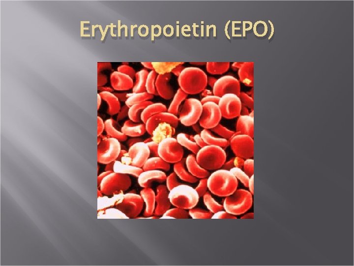 Erythropoietin (EPO) 