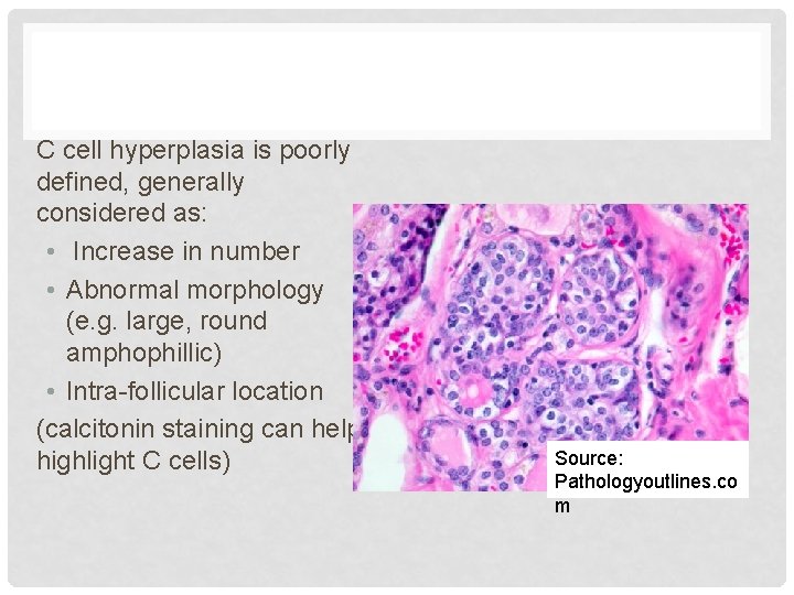 C cell hyperplasia is poorly defined, generally considered as: • Increase in number •