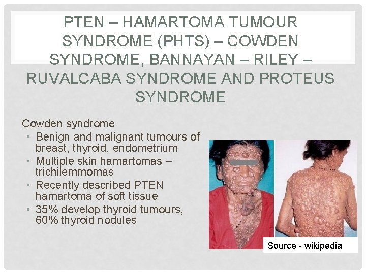 PTEN – HAMARTOMA TUMOUR SYNDROME (PHTS) – COWDEN SYNDROME, BANNAYAN – RILEY – RUVALCABA