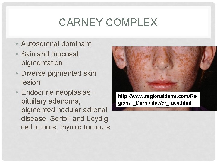 CARNEY COMPLEX • Autosomnal dominant • Skin and mucosal pigmentation • Diverse pigmented skin