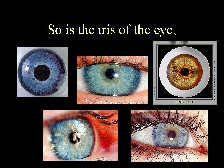 So is the iris of the eye, 